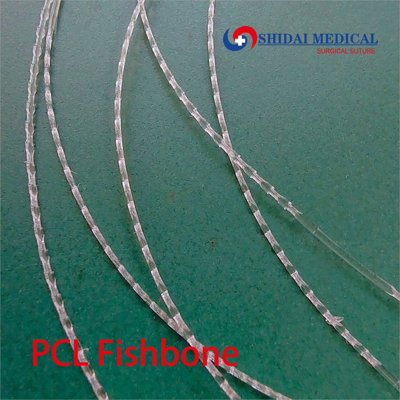 PCL fishbone