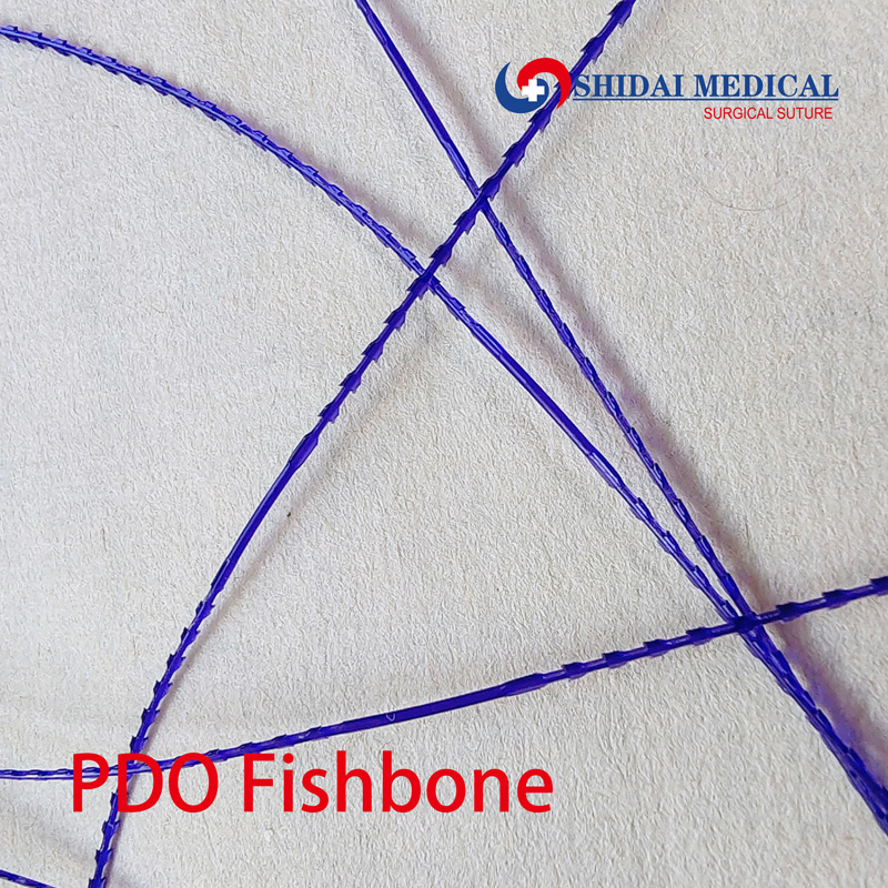 PDO fishbone